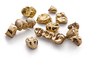 Juwelier Cohrs: Zahngold Ankauf Hannover: Zähne