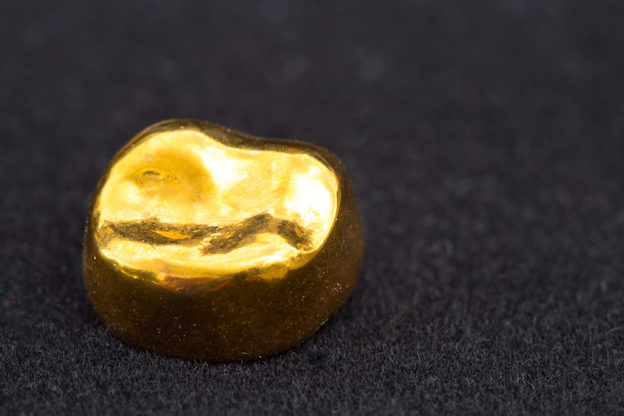 Dentalgold: Zahngold